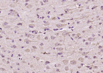 NARS2 Rabbit Polyclonal Antibody