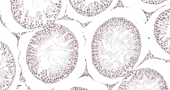 NASP Rabbit Polyclonal Antibody