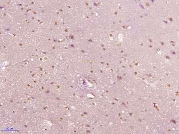 NCKIPSD Rabbit Polyclonal Antibody