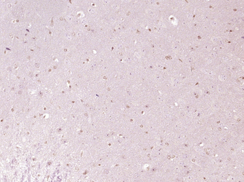 NCKIPSD Rabbit Polyclonal Antibody