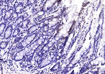 NCOA4 Rabbit Polyclonal Antibody