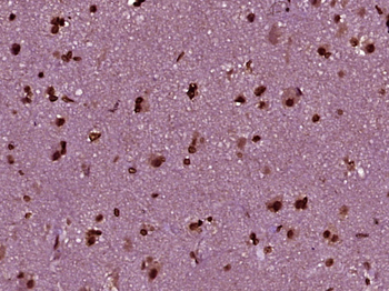 NCOA5 Rabbit Polyclonal Antibody
