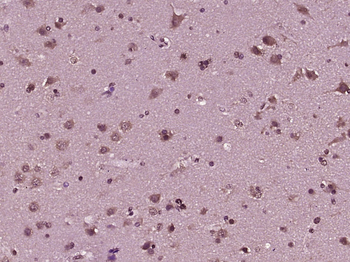 Nesprin 3 Rabbit Polyclonal Antibody