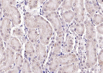 Nesprin 3 Rabbit Polyclonal Antibody