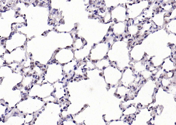 Nesprin 3 Rabbit Polyclonal Antibody