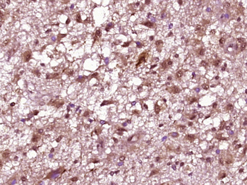 Phospho-NEUROD1 (Ser274) Rabbit Polyclonal Antibody