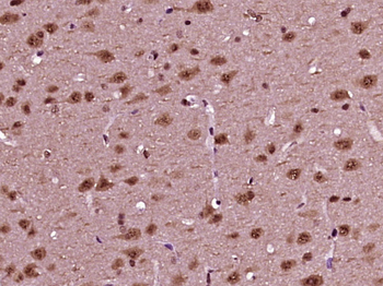 Phospho-NEUROD1 (Ser274) Rabbit Polyclonal Antibody