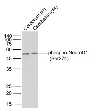 Phospho-NEUROD1 (Ser274) Rabbit Polyclonal Antibody
