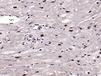 NOTCH4 Rabbit Polyclonal Antibody