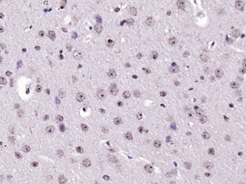 NOTCH4 Rabbit Polyclonal Antibody