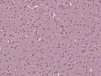 NOTCH4 Rabbit Polyclonal Antibody