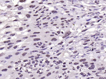 NOTCH4 Rabbit Polyclonal Antibody