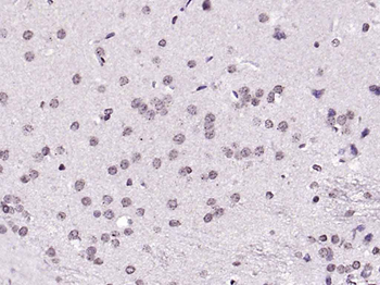 NOTCH4 Rabbit Polyclonal Antibody