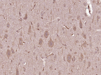 NME3 Rabbit Polyclonal Antibody