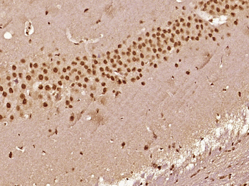 TAF15/RBP56 Rabbit Polyclonal Antibody