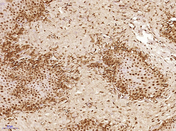 TAF15/RBP56 Rabbit Polyclonal Antibody