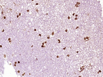 Nucleoplasmin 3 Rabbit Polyclonal Antibody