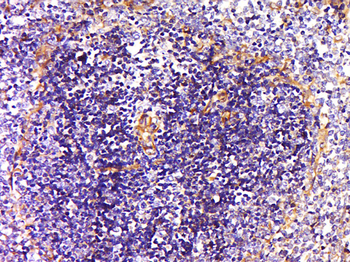NRAMP1 Rabbit Polyclonal Antibody