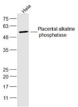 Placental alkaline phosphatase (PLAP) Rabbit Polyclonal Antibody