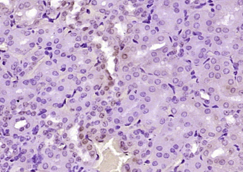 Phospho-PIM1 (Ser99) Rabbit Polyclonal Antibody