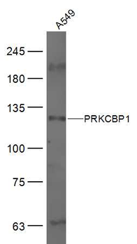 PRKCBP1 Rabbit Polyclonal Antibody