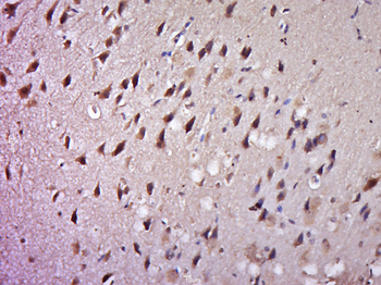 PGAM1 Rabbit Polyclonal Antibody