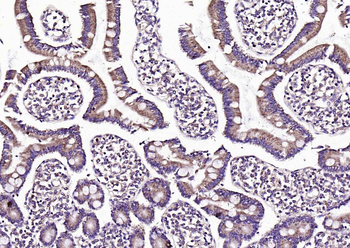 SAA1 Rabbit Polyclonal Antibody