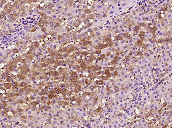 SAA1 Rabbit Polyclonal Antibody