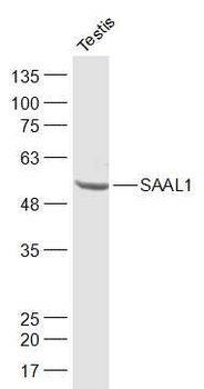 SAAL1 Rabbit Polyclonal Antibody