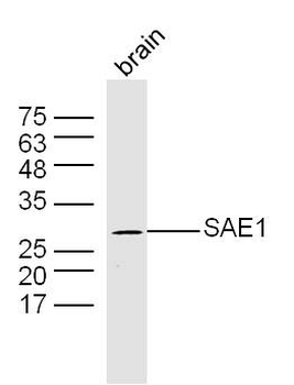 SAE1 Rabbit Polyclonal Antibody