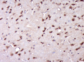 SAE2 / UBA2 Rabbit Polyclonal Antibody