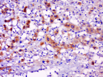 Tryptase delta Rabbit Polyclonal Antibody