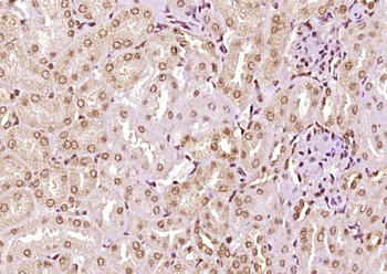 ZFP472 Rabbit Polyclonal Antibody