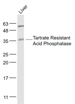 ACP5 Rabbit Polyclonal Antibody