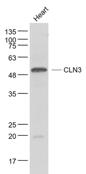 CLN3 Rabbit Polyclonal Antibody