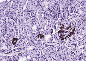 Notch1 Recombinant Rabbit Monoclonal Antibody