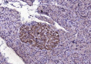Notch1 Recombinant Rabbit Monoclonal Antibody
