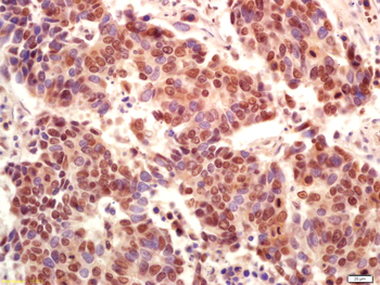 Phospho-PI3 Kinase p110 beta (Ser1070) Rabbit Polyclonal Antibody