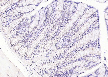 Phospho-PI3 Kinase p110 beta (Ser1070) Rabbit Polyclonal Antibody