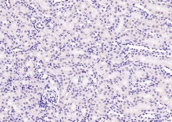 Phospho-PI3 Kinase p110 beta (Ser1070) Rabbit Polyclonal Antibody