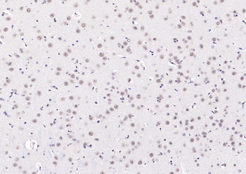 Phospho-PI3 Kinase p110 beta (Ser1070) Rabbit Polyclonal Antibody