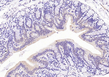 Phospho-PI3 Kinase p110 beta (Ser1070) Rabbit Polyclonal Antibody