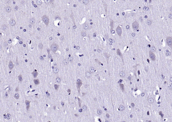 Phospho-PP2A alpha+beta (Tyr307) Rabbit Polyclonal Antibody