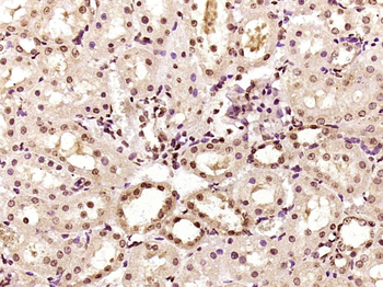 Phospho-PP2A alpha+beta (Tyr307) Rabbit Polyclonal Antibody