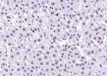 Phospho-PP2A alpha+beta (Tyr307) Rabbit Polyclonal Antibody