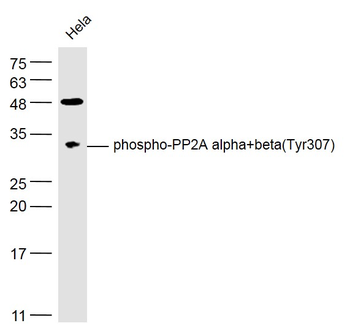 Phospho-PP2A alpha+beta (Tyr307) Rabbit Polyclonal Antibody