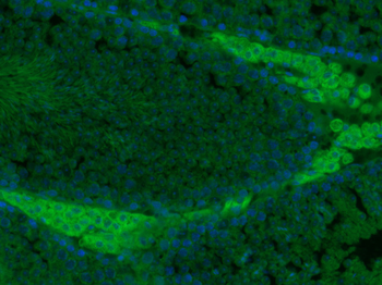 ADCK4 Rabbit Polyclonal Antibody