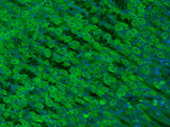 ADCK4 Rabbit Polyclonal Antibody