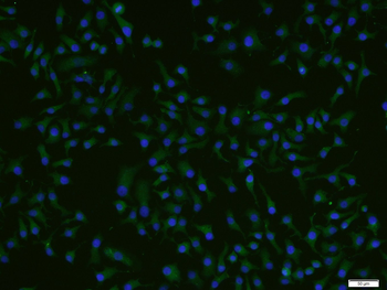 ADCK4 Rabbit Polyclonal Antibody