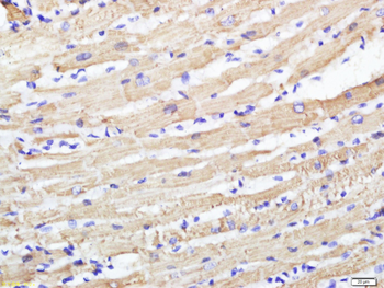 COQ8A Rabbit Polyclonal Antibody